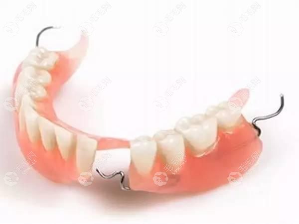 塑料胶连义齿舒适度一般