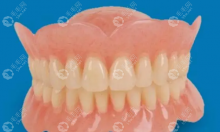 活动义齿哪种更舒服?吸附式义齿>铸造支架式义齿>胶连义齿