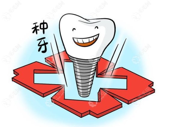 牙博士种植牙比医院贵很多吗www.5/9w.net