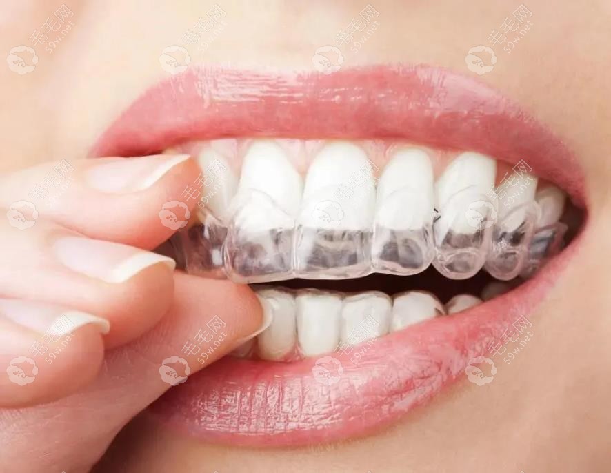 武汉中诺口腔医院牙齿隐形矫正多少钱