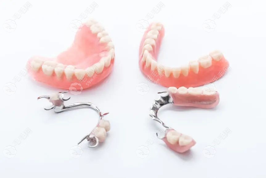 半口种植牙和假牙套的区别
