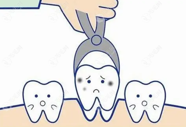 种牙填骨粉过程图解:5张图带您了解种植牙骨粉的作用和功效