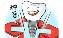 广州哪个医院种植牙便宜又好?广州广大-穗华口腔植牙技术好
