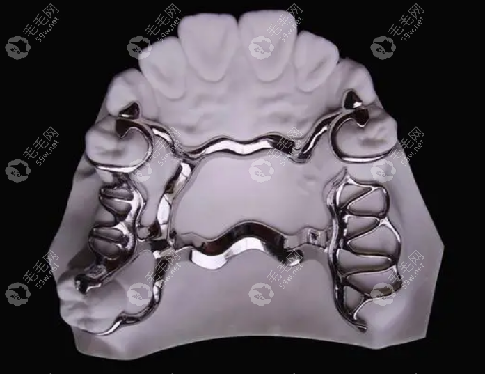维他灵活动牙是什么材质的?合金的,与纯钛的性价比不相上下