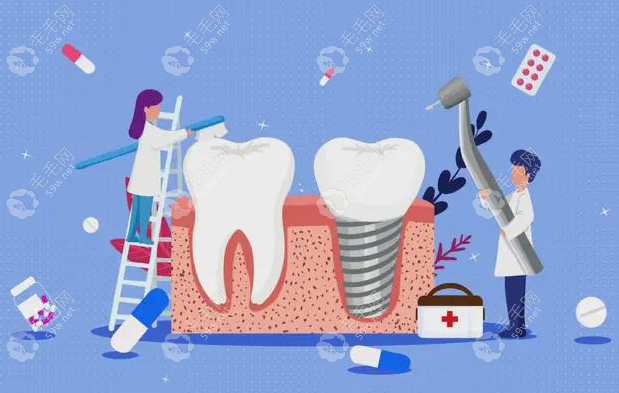 拔牙种牙可以一次完成是真的,但拔牙后立刻种牙的条件也高