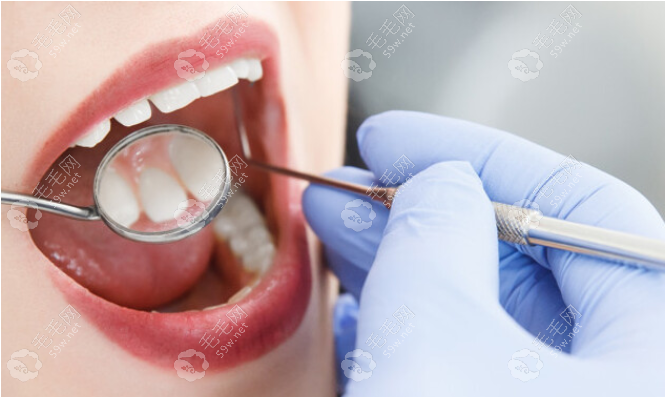很多人看牙都去私人牙科原因四私人牙科服务好