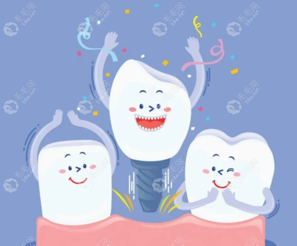 种植牙术后维护的好实用寿命更长