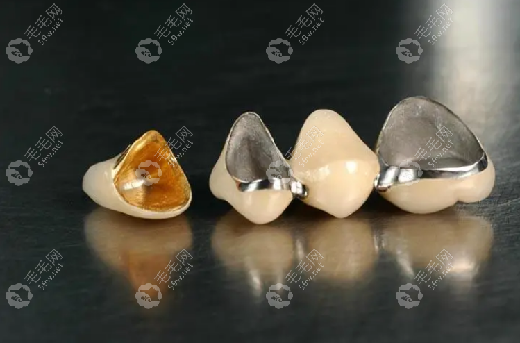 你来问我来答:惠州口腔医院烤瓷牙价格是500~6000元起一颗
