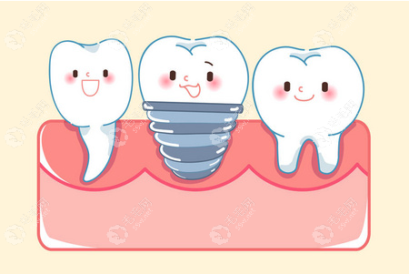 从种植牙的全部过程当中，了解到种植牙是怎么种植的呢？