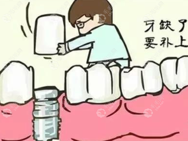 上海薇琳齿科种植牙实例评价好